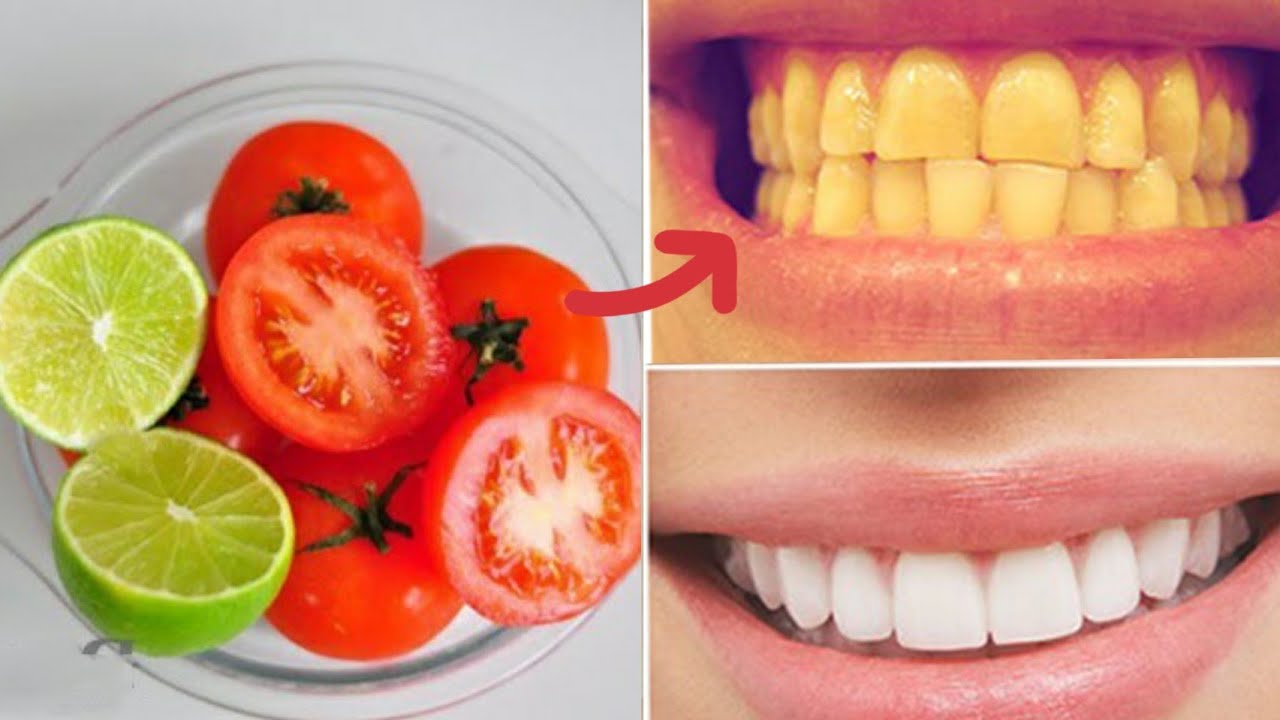 trắng răng bằng cà chua