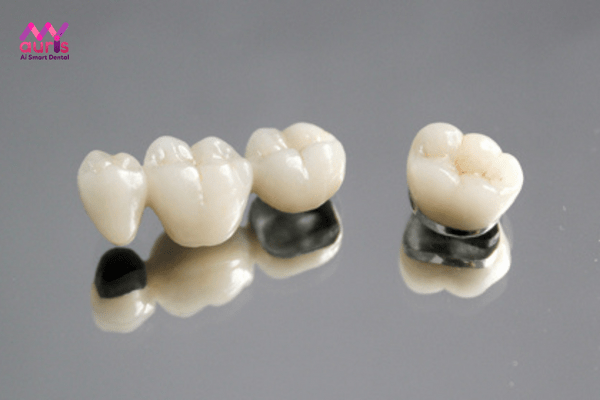 răng sứ titan có bị đen không