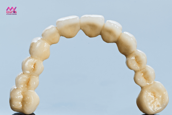 răng toàn sứ venus 