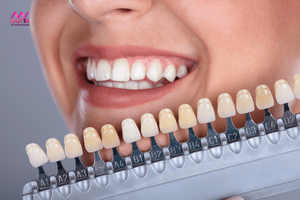 giá răng sứ katana zirconia