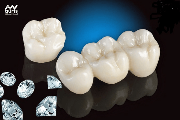  răng sứ diamond