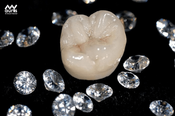  răng sứ diamond