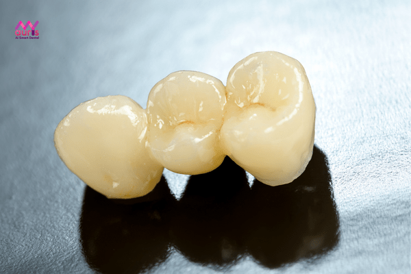 răng sứ zirconia bao nhiêu tiền