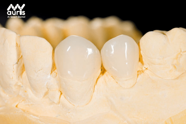 Răng toàn sứ Zirconia có tốt không?