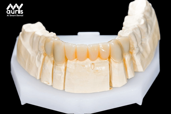 Răng sứ Zirconia là răng gì?